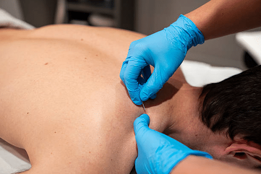 Current Physical Therapy | Dry Needling: Modern Relief for Muscle Pain